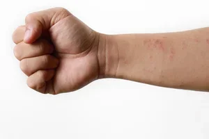 10 unterschätzte Massnahmen, die Ihre Haut beruhigen können